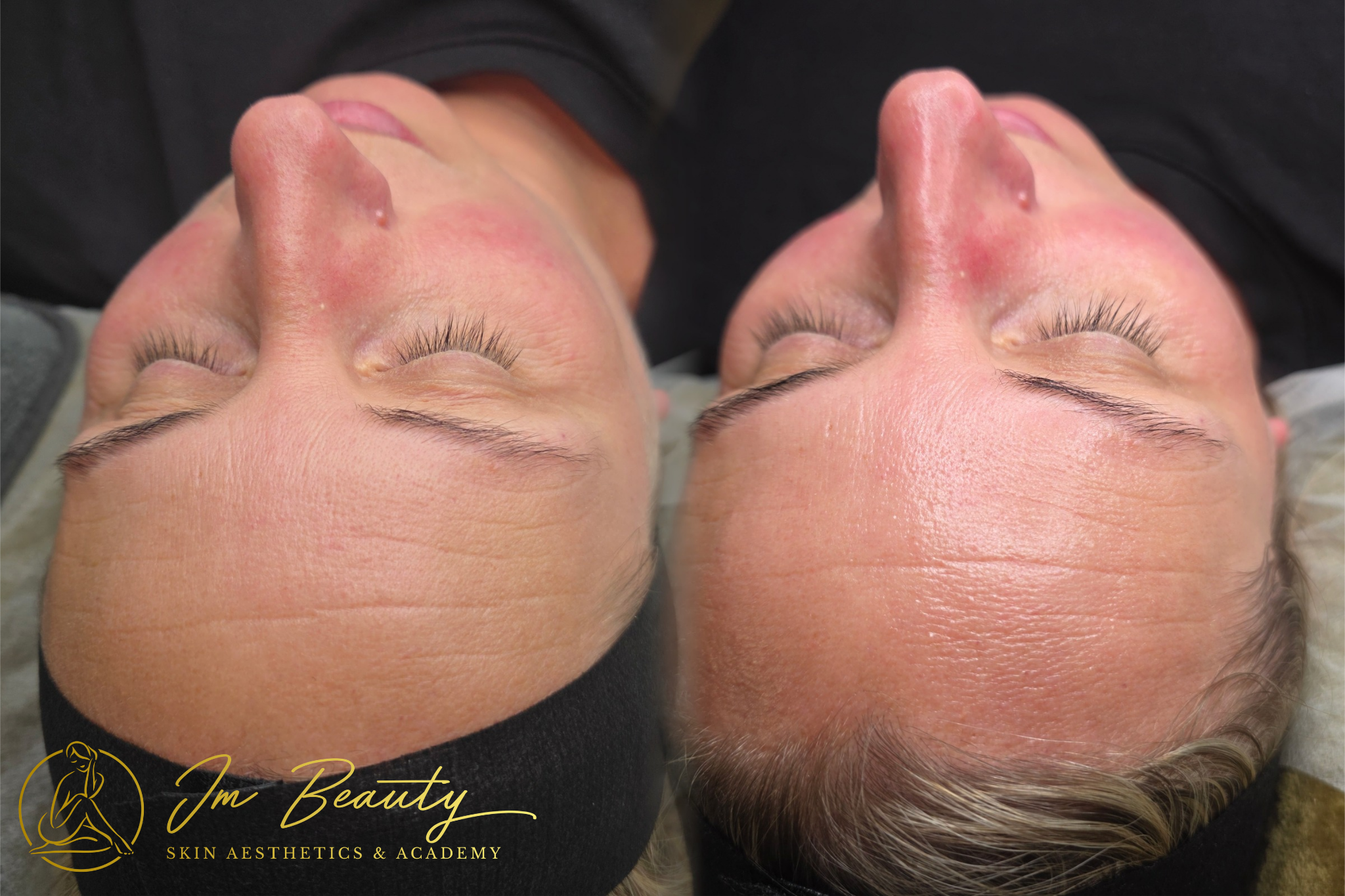 Anti-aging & hydratatie
